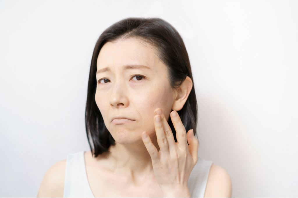 頬の乾燥や刺激を気にする中年女性。レチノールによるA反応に悩む表情