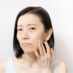 頬の乾燥や刺激を気にする中年女性。レチノールによるA反応に悩む表情